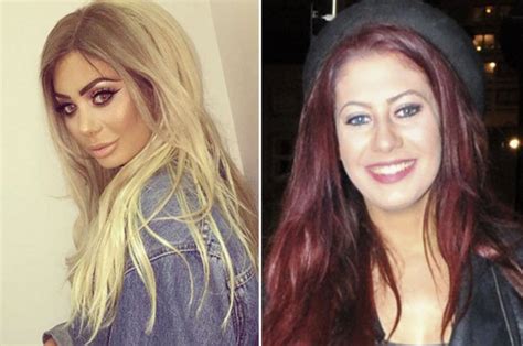 chloe mtv geordie shore|chloe ferry before and after.